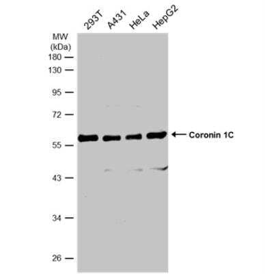 Western Blot: Coronin 3 Antibody [NBP1-31283]