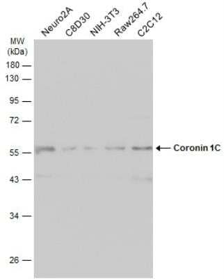 Western Blot: Coronin 3 Antibody [NBP1-31283]