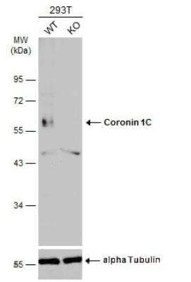 Western Blot: Coronin 3 Antibody [NBP1-31283]