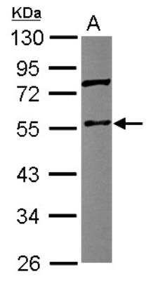 Western Blot: Coronin 3 Antibody [NBP2-15968]