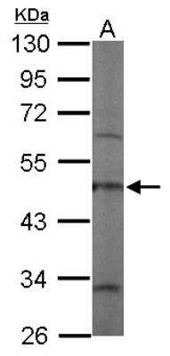 Western Blot: Coronin 3 Antibody [NBP2-15968]