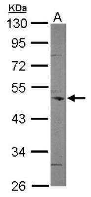 Western Blot: Coronin 3 Antibody [NBP2-15968]