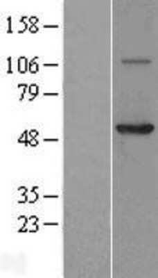 Western Blot: Coronin 3 Overexpression Lysate [NBL1-09398]