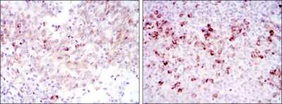 Immunohistochemistry: Cortactin Antibody (4C6) - BSA Free [NBP2-37621]