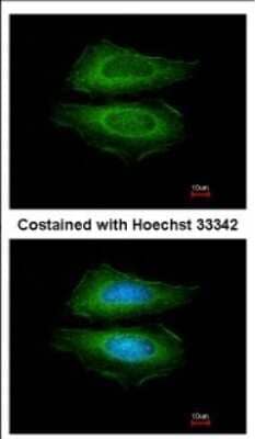 Immunocytochemistry/ Immunofluorescence: Cortactin Antibody [NBP2-15972]