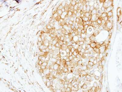 Immunohistochemistry-Paraffin: Cortactin Antibody [NBP2-15971]
