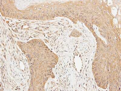 Immunohistochemistry-Paraffin: Cortactin Antibody [NBP2-15972]