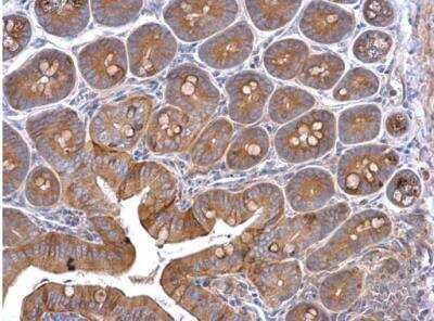 Immunohistochemistry-Paraffin: Cortactin Antibody [NBP2-15972]