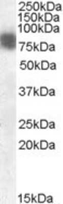 Western Blot: Cortactin Antibody [NB100-855]