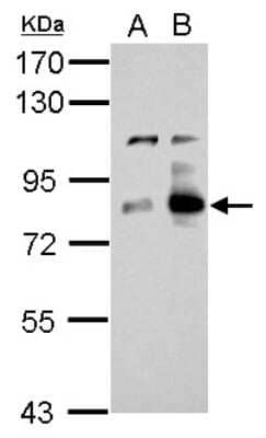 Western Blot: Cortactin Antibody [NBP2-15970]