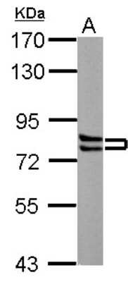 Western Blot: Cortactin Antibody [NBP2-15971]