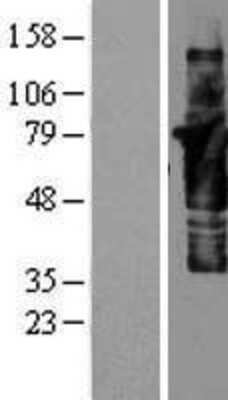 Western Blot: Cortactin Overexpression Lysate [NBP2-04417]