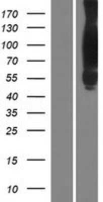 Western Blot: Cortactin Overexpression Lysate [NBP2-10483]