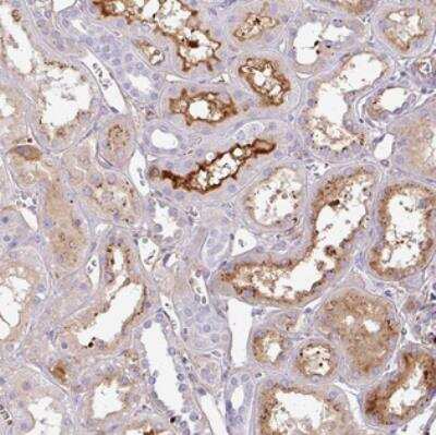 Immunohistochemistry: Cortexin 2 Antibody [NBP2-30534]