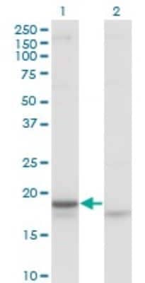 Western Blot: Corticotropin Releasing Factor Antibody (2B11) [H00001392-M02]