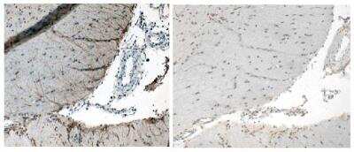 Immunohistochemistry: Corticotropin Releasing Factor Antibody - Azide and BSA Free [NB110-81721]