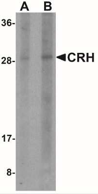 Western Blot: Corticotropin Releasing Factor AntibodyBSA Free [NBP2-41273]