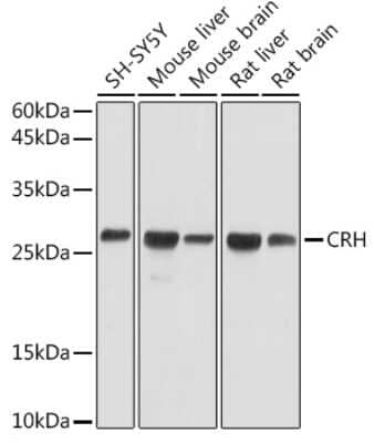 Western Blot: Corticotropin Releasing Factor AntibodyBSA Free [NBP3-15356]