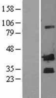 Western Blot: Corticotropin Releasing Factor Overexpression Lysate [NBL1-09475]