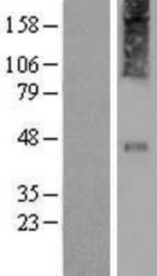 Western Blot: CRHR2/CRF2 Overexpression Lysate [NBP2-10779]