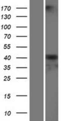 Western Blot: Serpin A6/Cortisol Binding Globulin Overexpression Lysate [NBP2-10771]