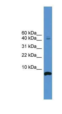 Western Blot: Cortistatin Antibody [NBP1-69148]