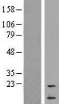 Western Blot: Cortistatin Overexpression Lysate [NBP2-10969]