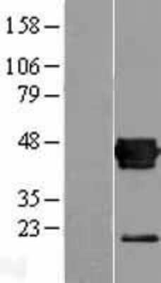 Western Blot: CXADR Overexpression Lysate [NBL1-09620]