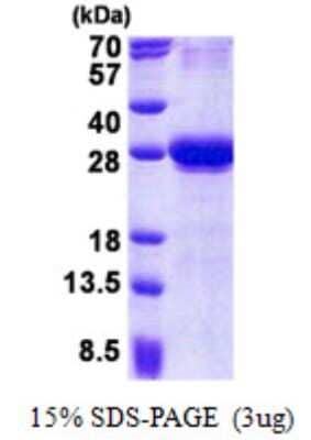 SDS-PAGE: Recombinant Human CXADR His Protein [NBP2-22802]