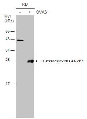Western Blot: Coxsackievirus A6 VP3 Antibody [NBP3-13130]