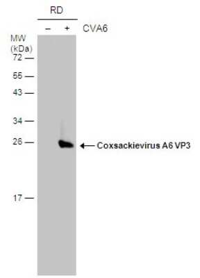 Western Blot: Coxsackievirus A6 VP3 Antibody [NBP3-13131]