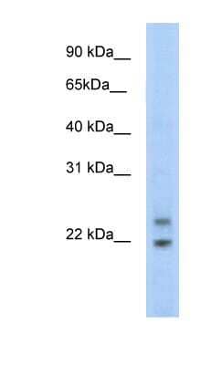 Western Blot: Cphx Antibody [NBP1-91616]