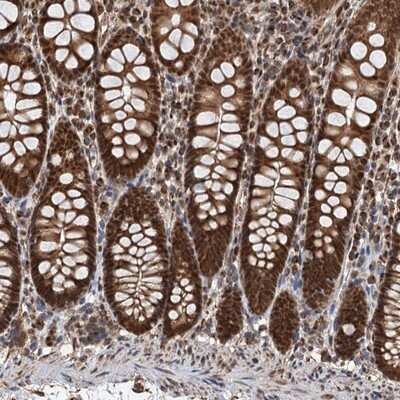 Immunohistochemistry-Paraffin: Craniofacial Development Protein 1 Antibody [NBP1-88680]