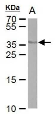 Western Blot: Cre Antibody (10212) [NBP2-42832]