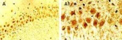 Immunohistochemistry: Cre Antibody [NB100-56134]