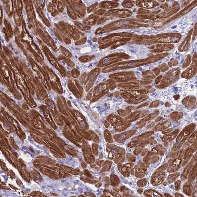 Immunohistochemistry-Paraffin: Creatine Kinase, Muscle/CKMM Antibody [NBP2-13839]