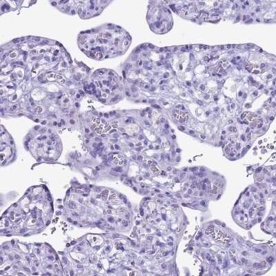 Immunohistochemistry-Paraffin: Creatine Kinase, Muscle/CKMM Antibody [NBP2-13839]
