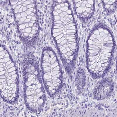 Immunohistochemistry-Paraffin: Creatine Kinase, Muscle/CKMM Antibody [NBP2-13839]
