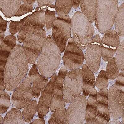 Immunohistochemistry-Paraffin: Creatine Kinase, Muscle/CKMM Antibody [NBP2-13839]