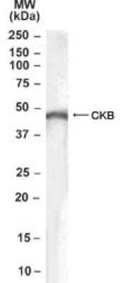 Western Blot: Creatine Kinase BB Antibody [NB100-2847]