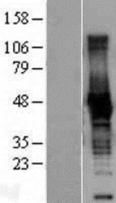 Western Blot: Creatine Kinase BB Overexpression Lysate [NBL1-09218]