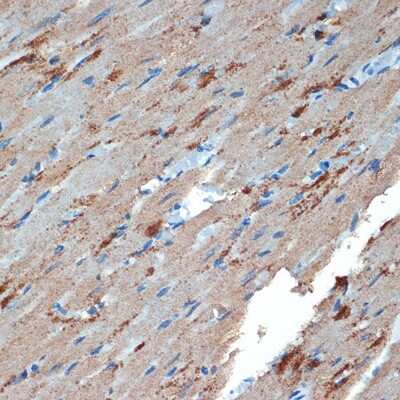 Immunohistochemistry-Paraffin: Creatine Kinase BB Antibody (1G10U9) [NBP3-16510]