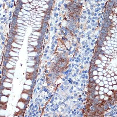 Immunohistochemistry-Paraffin: Creatine Kinase BB Antibody (1G10U9) [NBP3-16510]