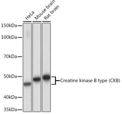 Western Blot: Creatine Kinase BB Antibody (1G10U9) [NBP3-16510]