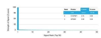 Protein Array: Creatine Kinase BB Antibody (2ba6) - Azide and BSA Free [NBP2-59601]