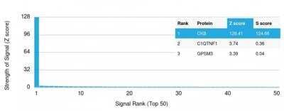 Protein Array: Creatine Kinase BB Antibody (CKB/1268) [NBP2-75762]