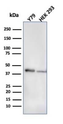 Western Blot: Creatine Kinase BB Antibody (CPTC-CKB-2)Azide and BSA Free [NBP3-08866]