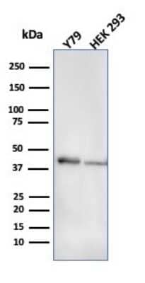 Western Blot: Creatine Kinase BB Antibody (CPTC-CKB-2) [NBP3-07542]