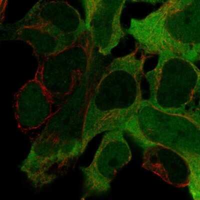 Immunocytochemistry/ Immunofluorescence: Creatine Kinase BB Antibody [NBP1-84460]