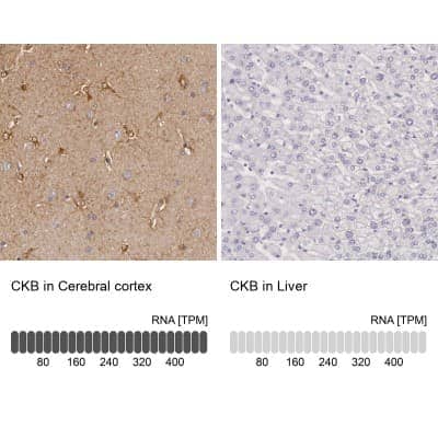 Immunohistochemistry-Paraffin: Creatine Kinase BB Antibody [NBP1-84460]